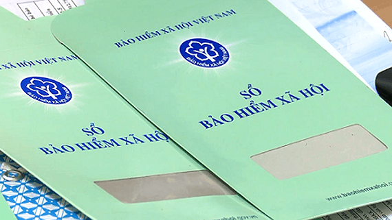 Does fixed work contract have to pay social insurance?