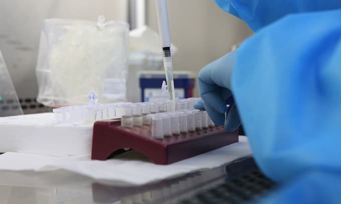 Vietnam to use TB test for Covid-19