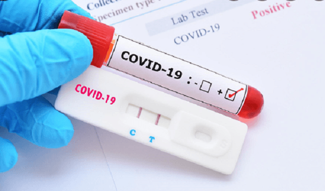 Is the COVID-19 test fee taxable?