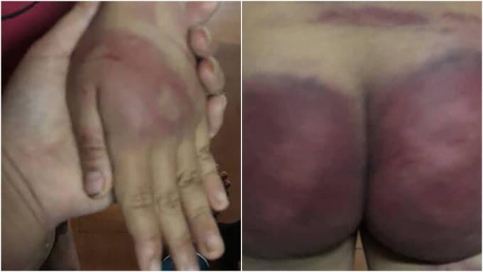 Spare the rod, spoil the child approach scar Vietnamese children