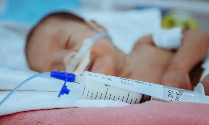 Formula feeding increases infants' infection, hospitalization rates: study