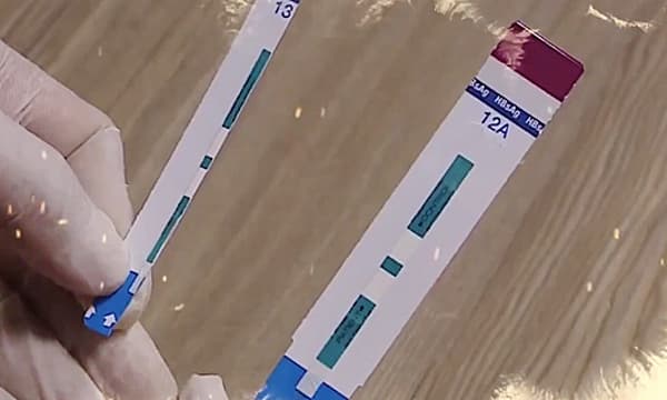 Hanoi hospital cuts HIV, hepatitis B test strips into two