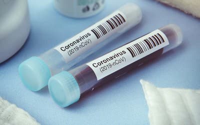 Nation confirms no fresh COVID-19 cases, 15 in treatment left