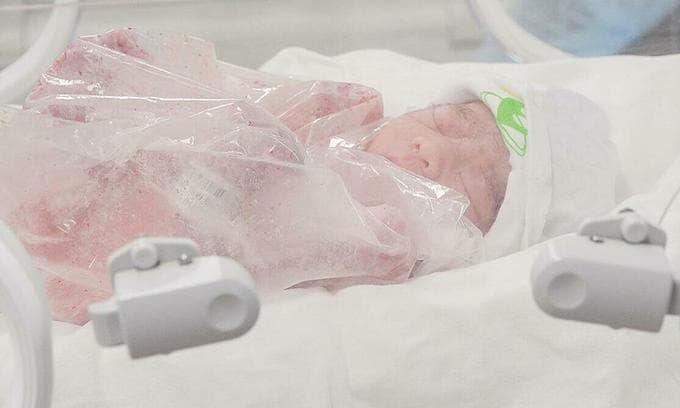 Vietnamese doctors break with convention to save fetus