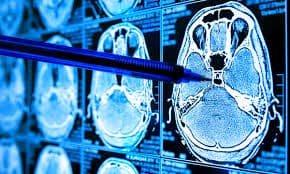 Online seminar on AI application in healthcare to commence Wednesday