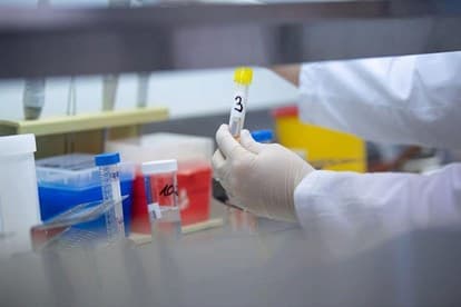 One more Indian expert tests positive for COVID-19