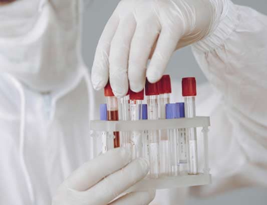 Ha Noi conducts 1.3 million RT-PCR tests through next Wednesday